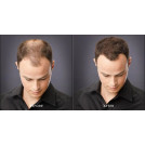 Загуститель для волос Toppik Hair Building Fibers Темно Коричневый (Dark brown)