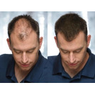 Загуститель для волос Toppik Hair Building Fibers Темно Русый (Light brown)